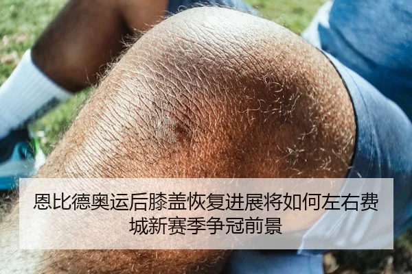 恩比德奥运后膝盖恢复进展将如何左右费城新赛季争冠前景